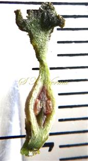  V.S. Ovary